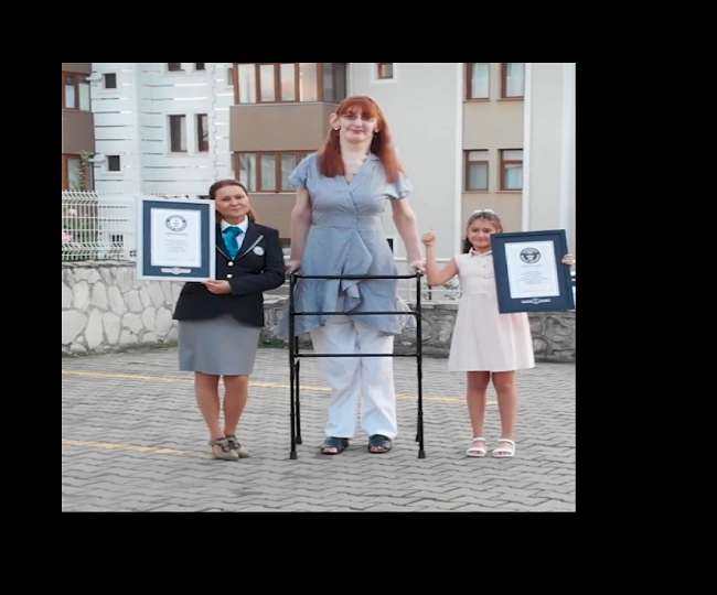 Turkey’s Rumeysa Gelgi, with weaver syndrome, breaks Guinness World Record for ‘tallest women’  